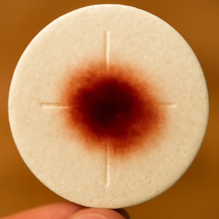 The Bloody Host: How a Fungal Infestation Became a Eucharistic Miracle
